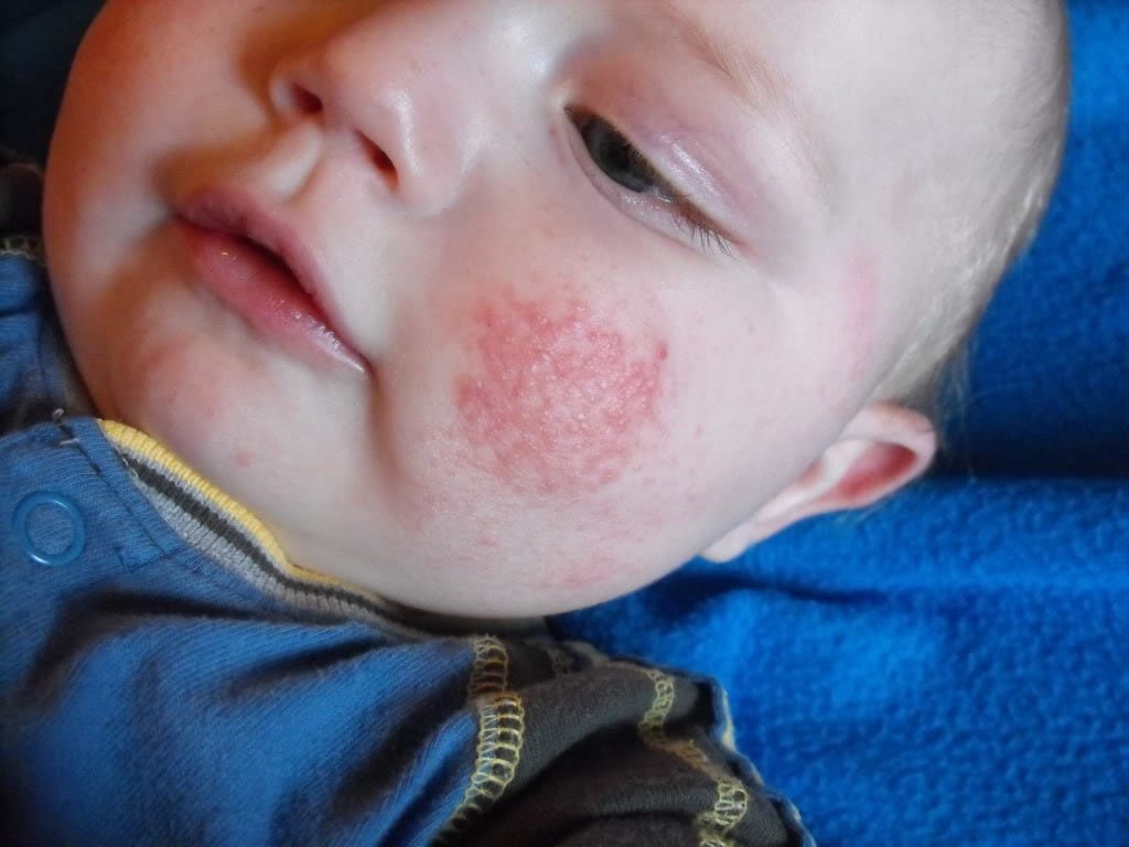 Vir:community.babycenter.com