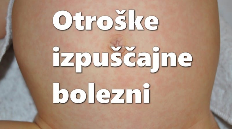 Otroške izpuščajne bolezni - kako prepoznati izpuščaj?