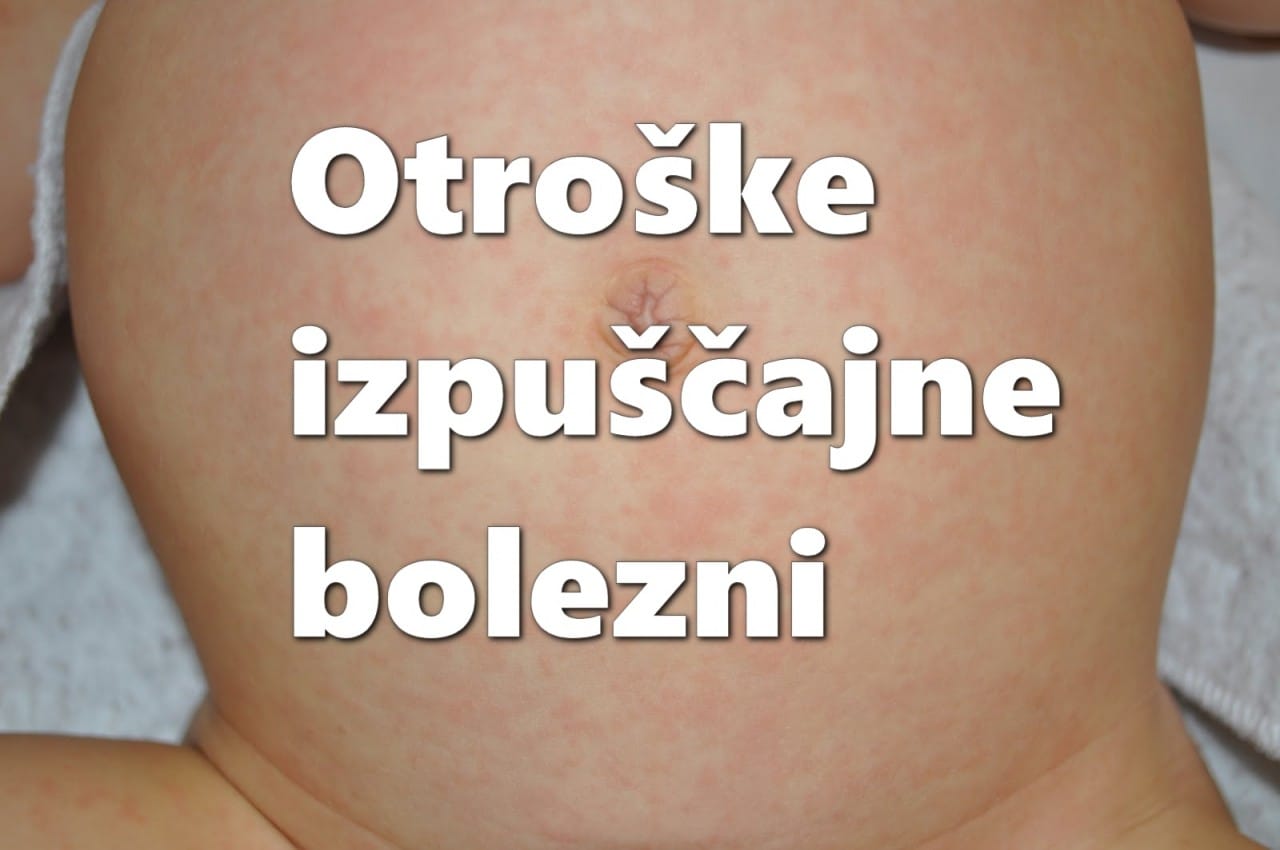 Otroške izpuščajne bolezni - kako prepoznati izpuščaj?