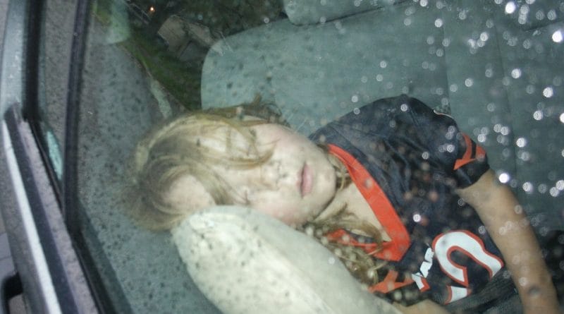 Tortikolis - kriv vrat