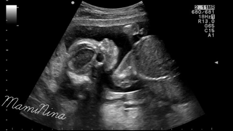 Nosečniški dnevnik 2: morfologija