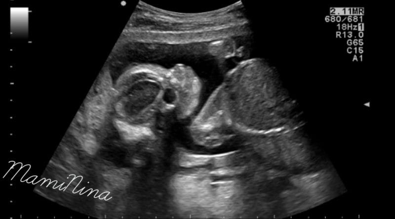 Nosečniški dnevnik 2: morfologija