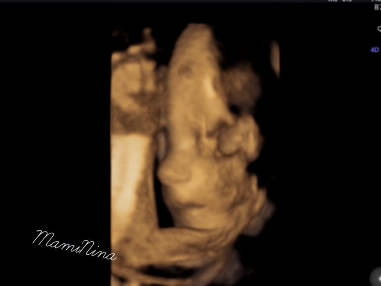 Nosečniški dnevnik 2: 3D/4D ultrazvok