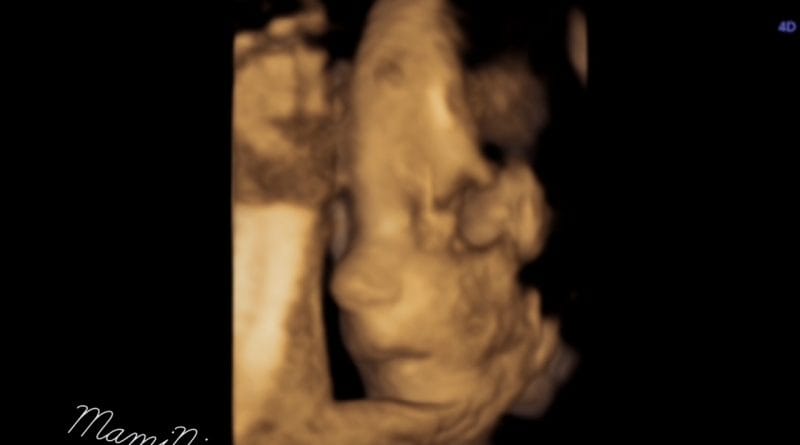 Nosečniški dnevnik 2: 3D/4D ultrazvok