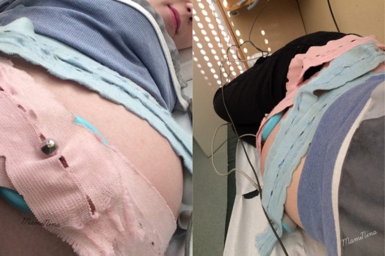 Redni nosečniški pregled pri 37. tednih