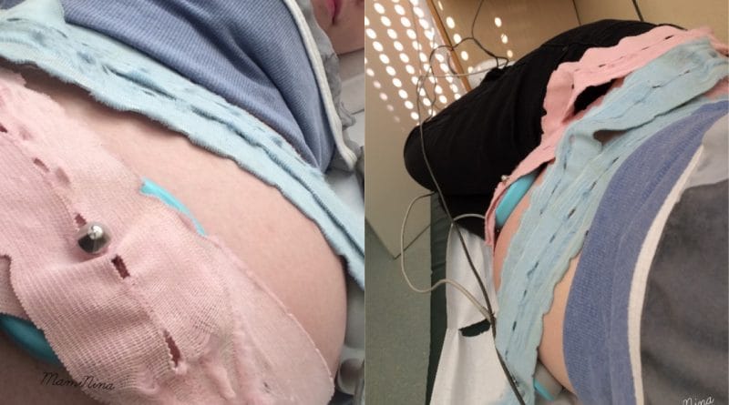 Redni nosečniški pregled pri 37. tednih