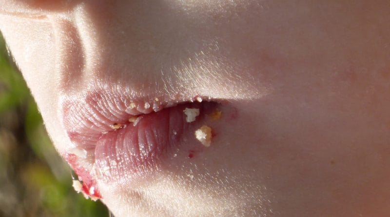 Ko imamo doma izbirčnega jedca