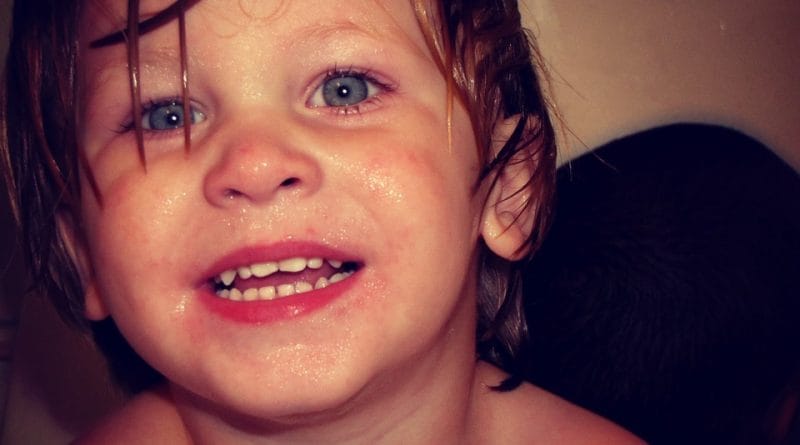 Nad vročino pri otroku brez zdravil